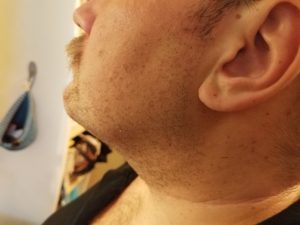 ADLER-AD-2923-Rasierer-nach-der-Rasur