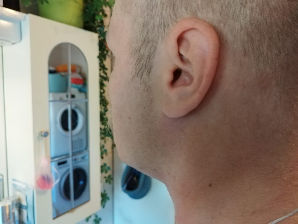 Philips-Shaver-Series-3000-Modell-S314500-Rasierer-nach-dem-Rasieren