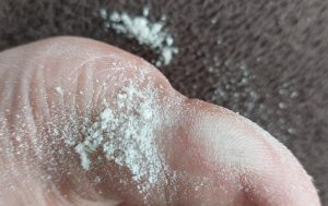 VOYOR BM300 Epilierer Fuß nach Hornhautbehandlung mit Abtragungen