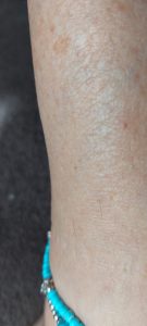 VOYOR BM300 Epilierer Haare vor dem Epilieren