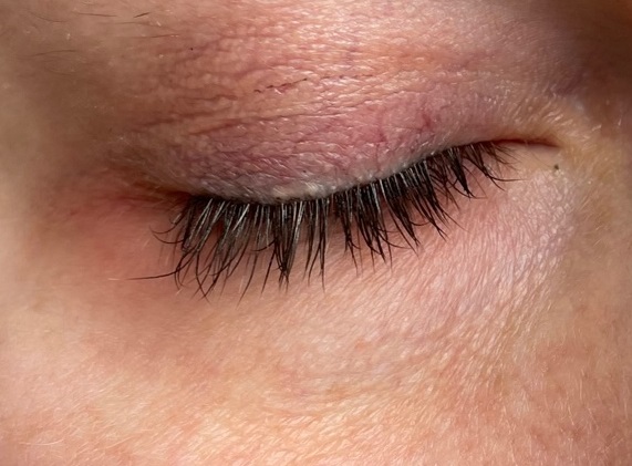 FQQF Wimpernserum Ergebnis