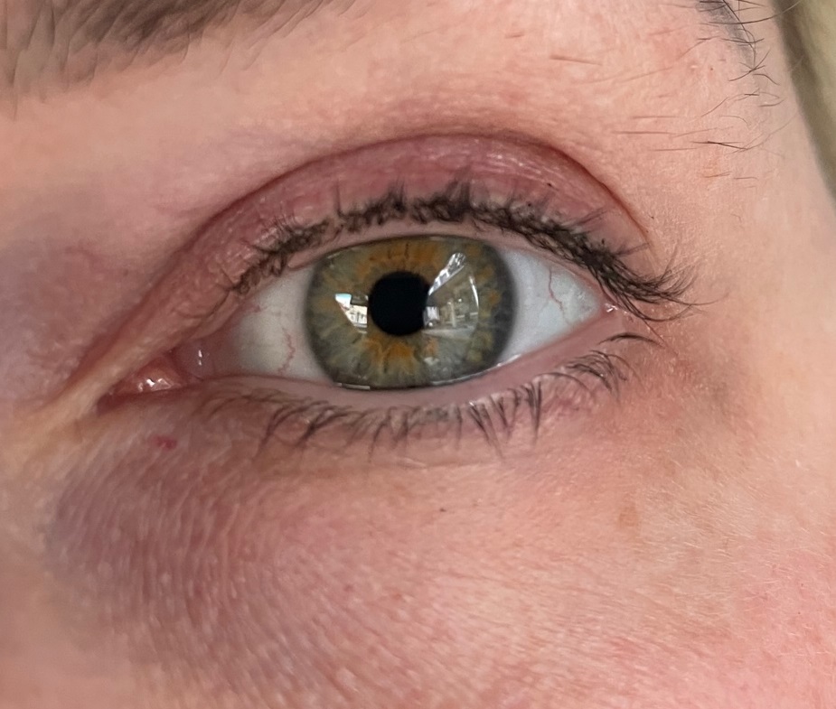 FQQF Wimpernserum Resultat