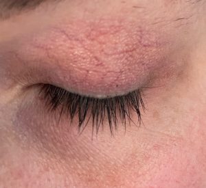 ORPHICA Realash Wimpernserum Ergebnis