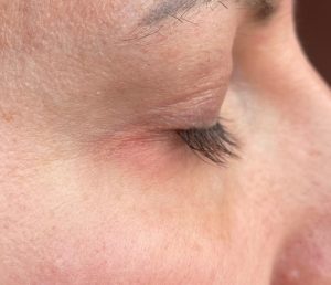 Oceanic Long4Lashes FX5 Wimpernserum Rötung