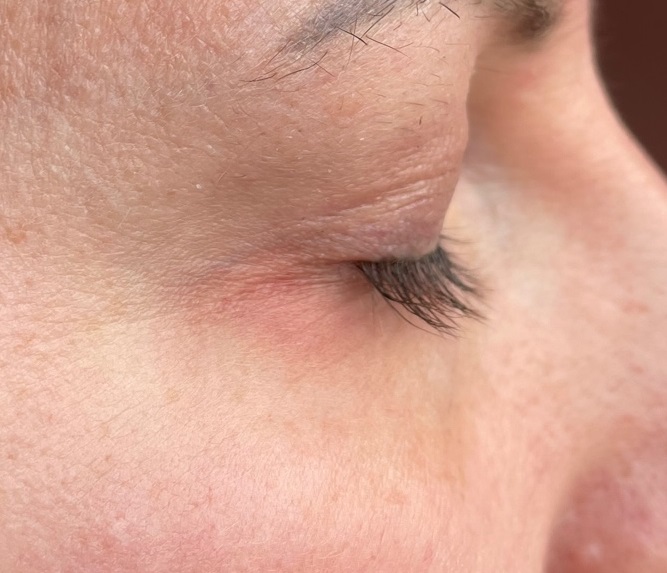 Oceanic Long4Lashes FX5 Wimpernserum Rötung