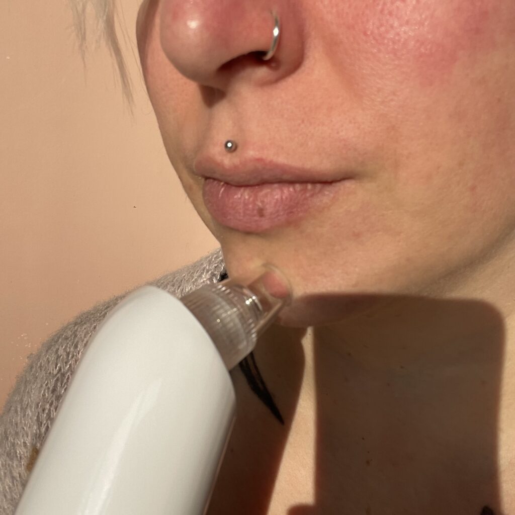 Beurer FC 41 Porenreiniger im Einsatz