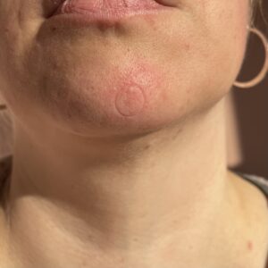 Grundig Porenreiniger Abdruck