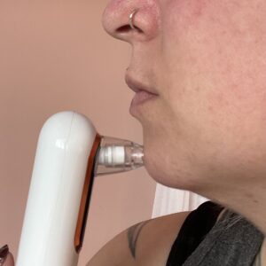 YCCU Blackhead Remover Porenreiniger Test