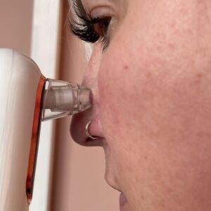 YCCU Blackhead Remover Porenreiniger im Einsatz