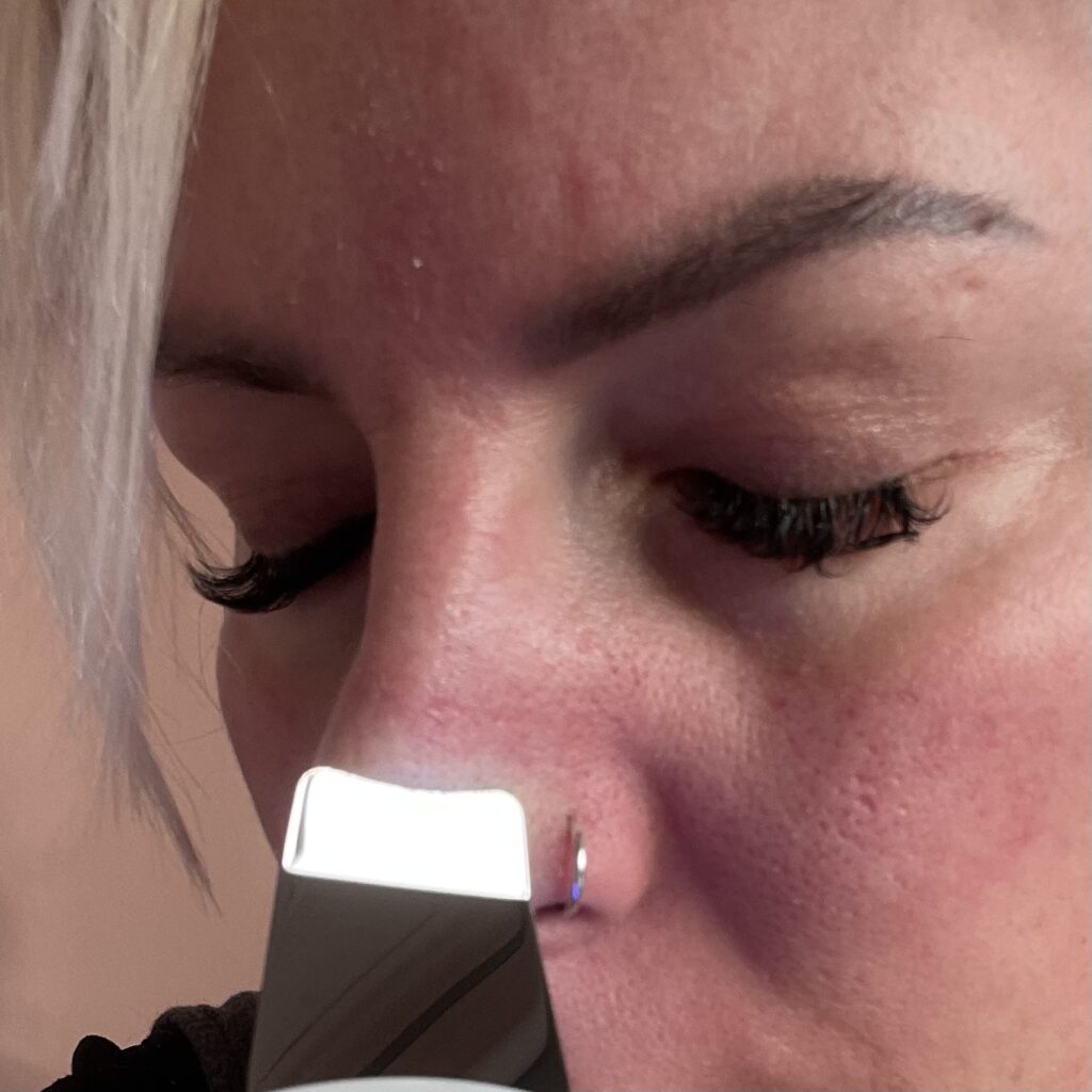 Yeerain Porenreiniger im Einsatz